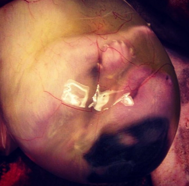 foto:Renata Magaldi  - lo hecho en México